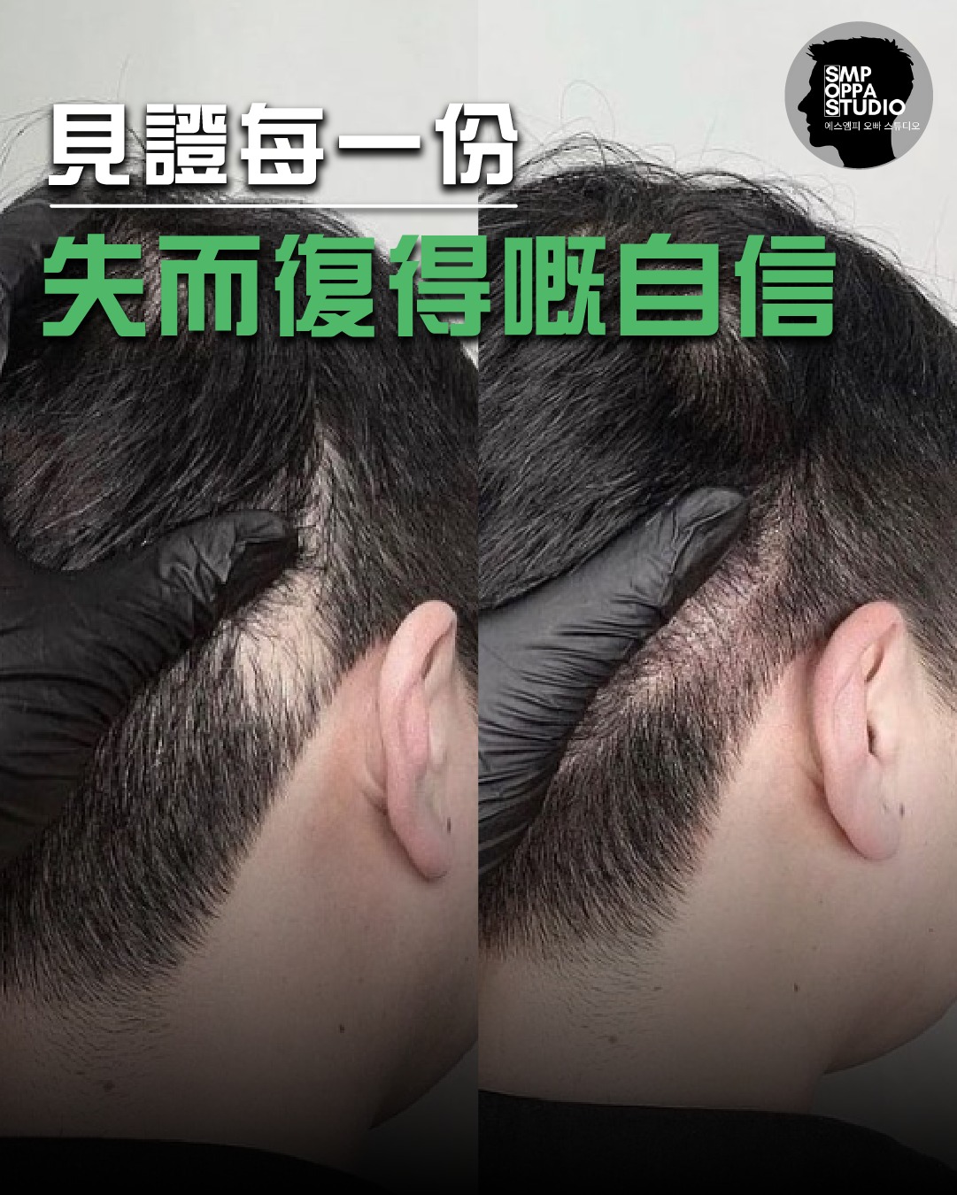 紋髮副作用與風險